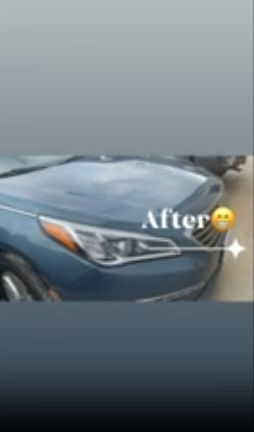 Hyundai After